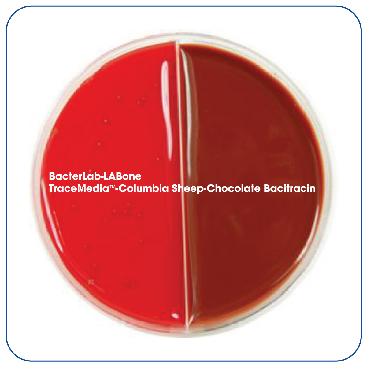 TraceMedia™ Columbia Sheep/Chocolate Bacitracin Bacterlab