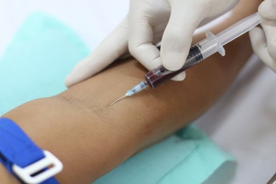 Lấy máu bằng xy-lanh trên cơ thể bệnh nhân